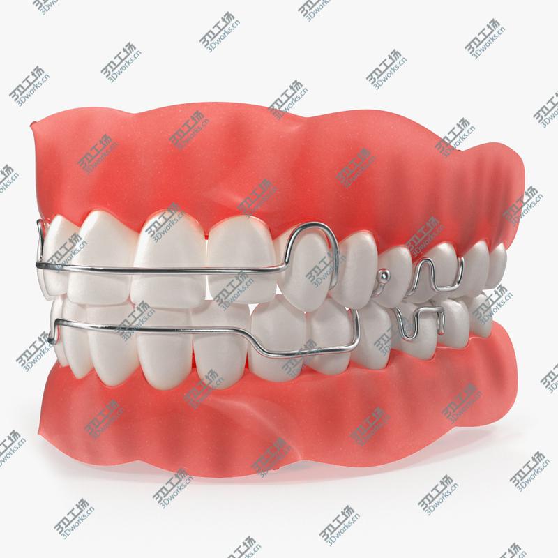 images/goods_img/2021040165/Typodont Tooth Orthodontic Retainer model/1.jpg